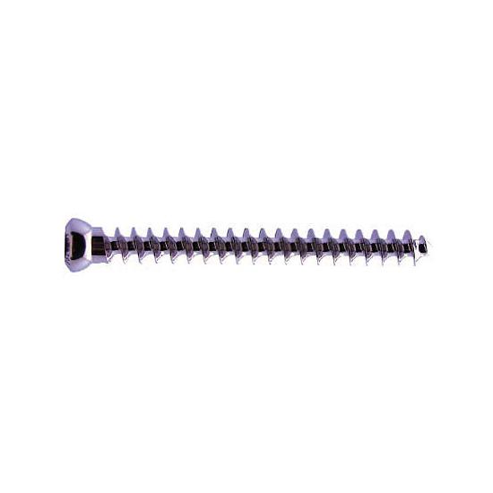 VIS SPONG.AUTOT.D4X20MM TTE FIL.1584